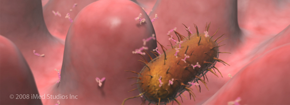 ecoli-iMed